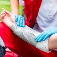 What Are Common Burn Injuries and Their Causes?